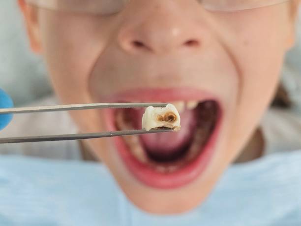 Best Emergency Gum Pain Relief  in Bastrop, TX